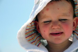 Wie kann ich meine Kinder gegen Mückenstiche schützen?